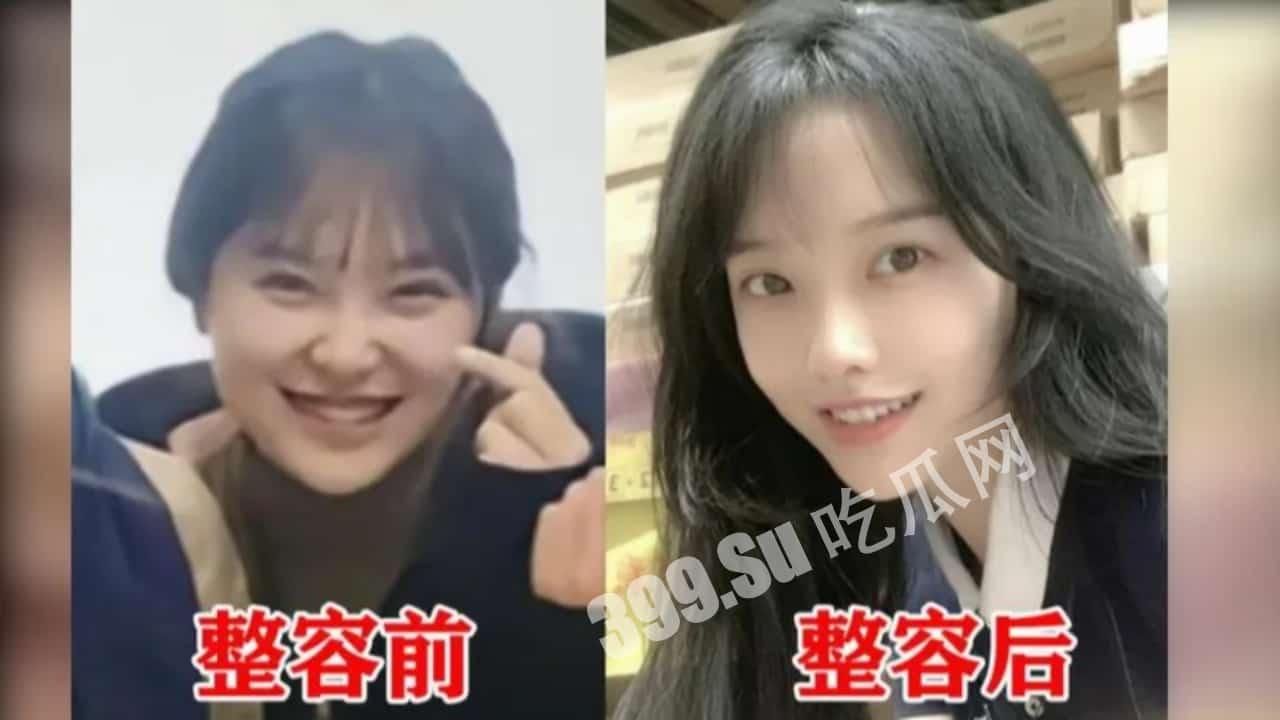 「挖呀挖老师」甜美笑眼全靠滤镜？ 前同事爆料整容前照片 爆红后「从身分→颜质」遭全方位抹黑  直播中不禁落泪-7