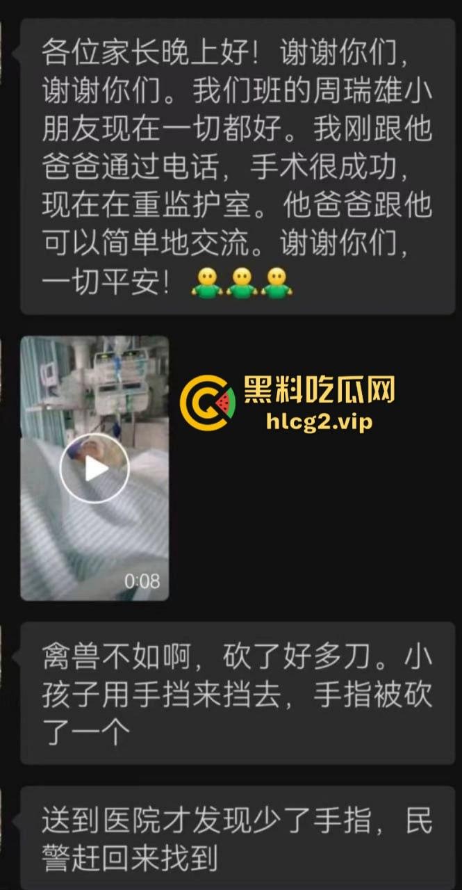 两口子吵架不比谁嗓门大 竟然砍下儿子手指 这操作竟然是亲妈？-1