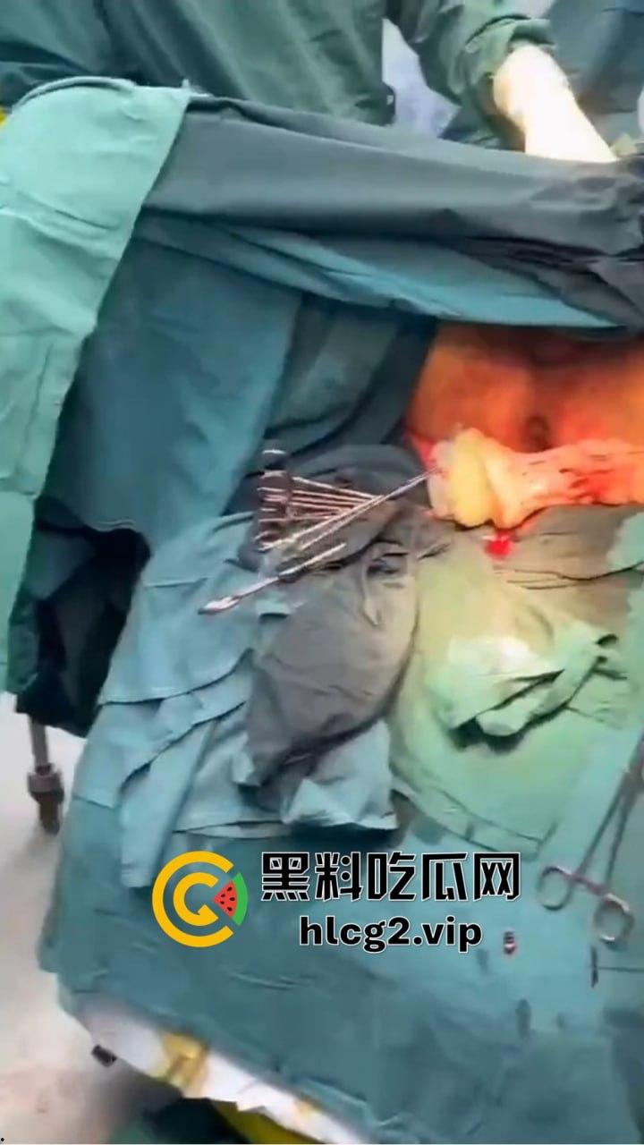 重口慎点！男子硬塞20厘米假体进体内，女子螃蟹夹逼狠整，为了流量太拼了！-7