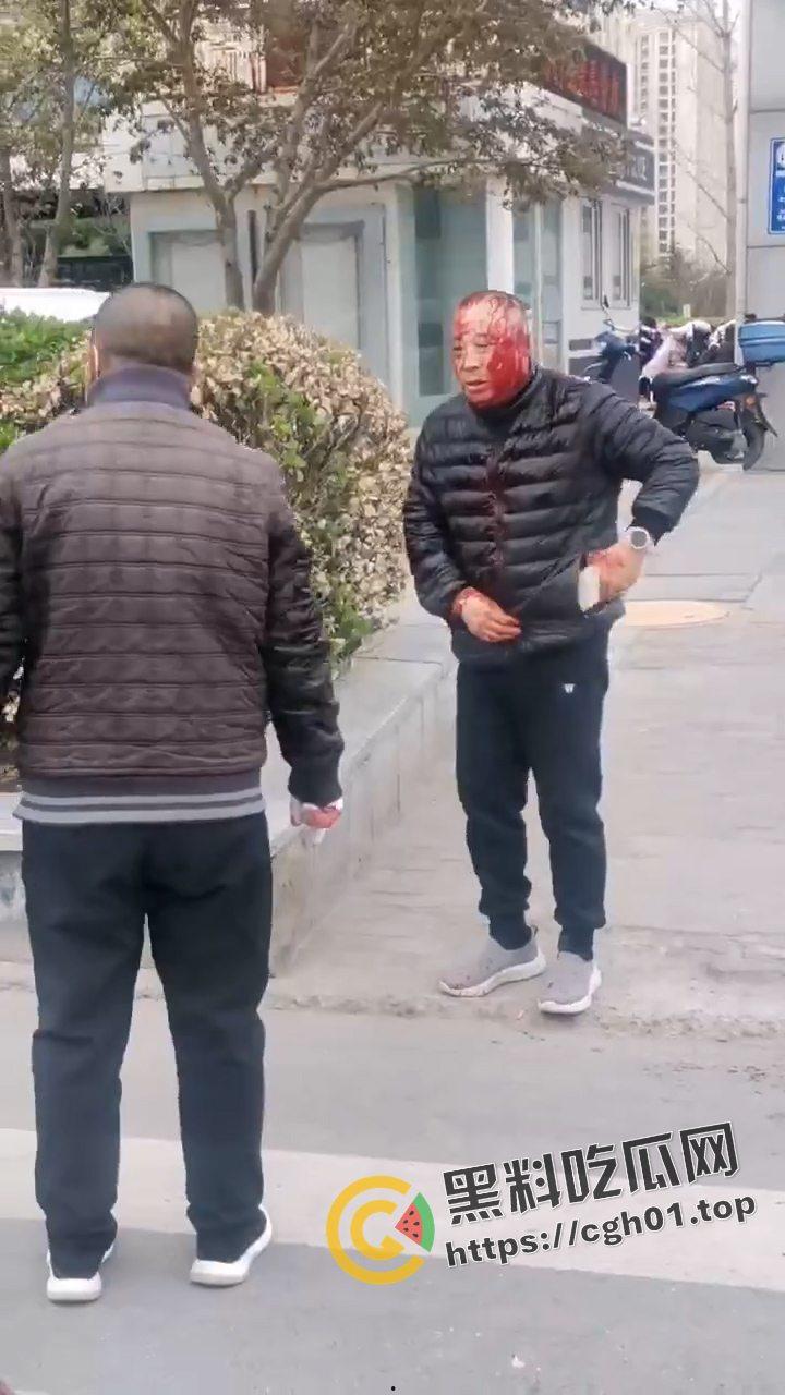 河北燕郊滴滴大战出租车！因为15元得单子出租车司机拿螺丝刀把滴滴司机脑袋捅烂 现场血腥画面流出-7