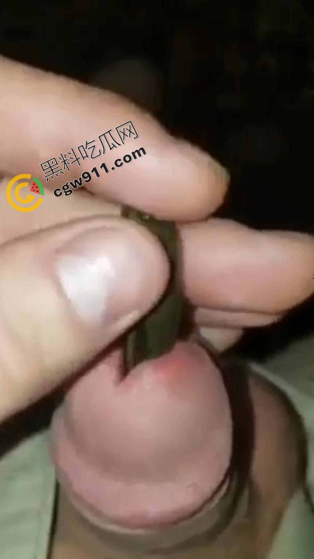 恐怖刺激！活蚂蟥钻入男子大屌的惊悚作死视频，观看者直呼恶心，视觉冲击骇人听闻-3