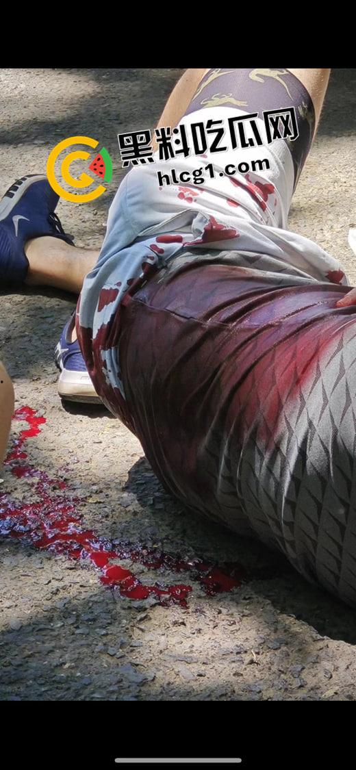 吉林四名外国教师公园参观被刺杀 凶手仍流落在外 现场血腥视频流出-3