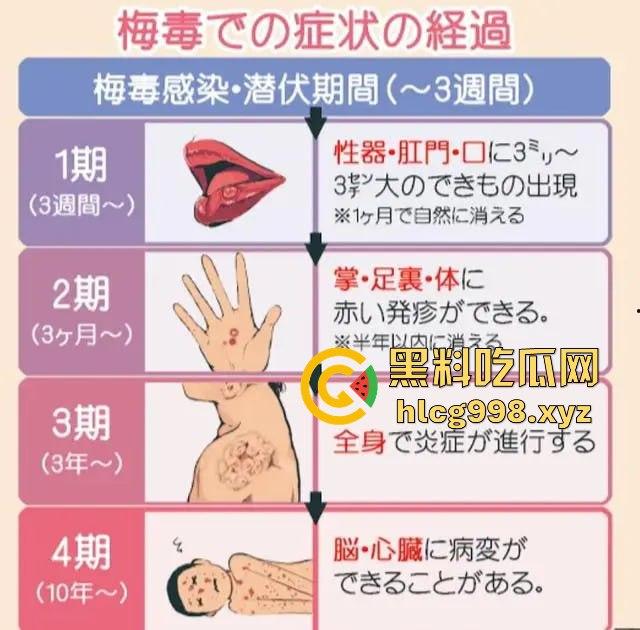 梅毒像疯狗一样乱咬!日本疫情横扫全球,日本卫生部出狠招断根大法安排上,管不住下半身只能禁爱?-10