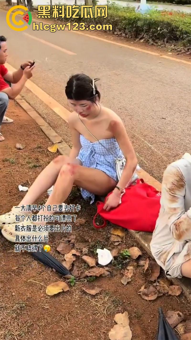 一生要强的中国女人,就算出车祸一身伤,也是必须要出片,不管摔成什么样拍照才是第一位!-2