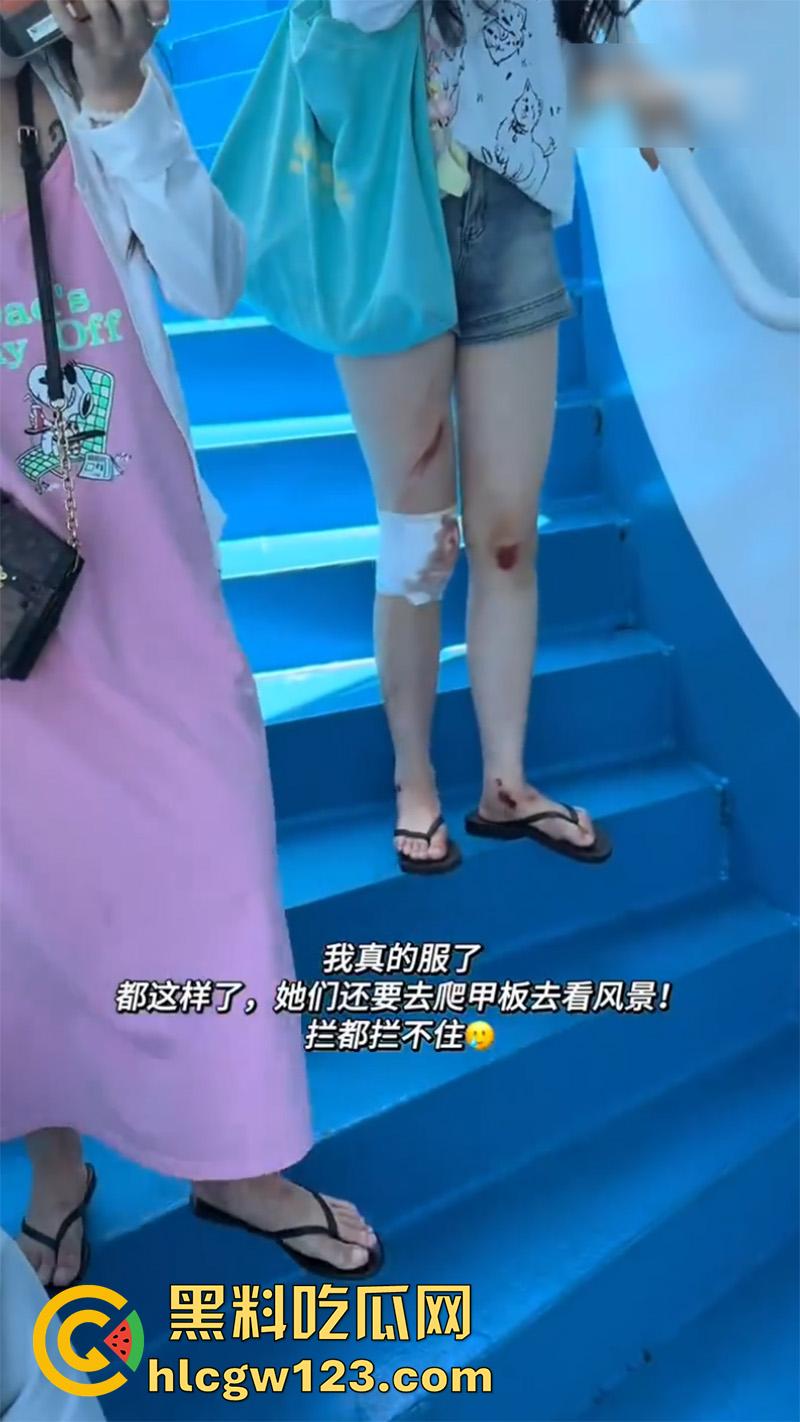 一生要强的中国女人,就算出车祸一身伤,也是必须要出片,不管摔成什么样拍照才是第一位!-7