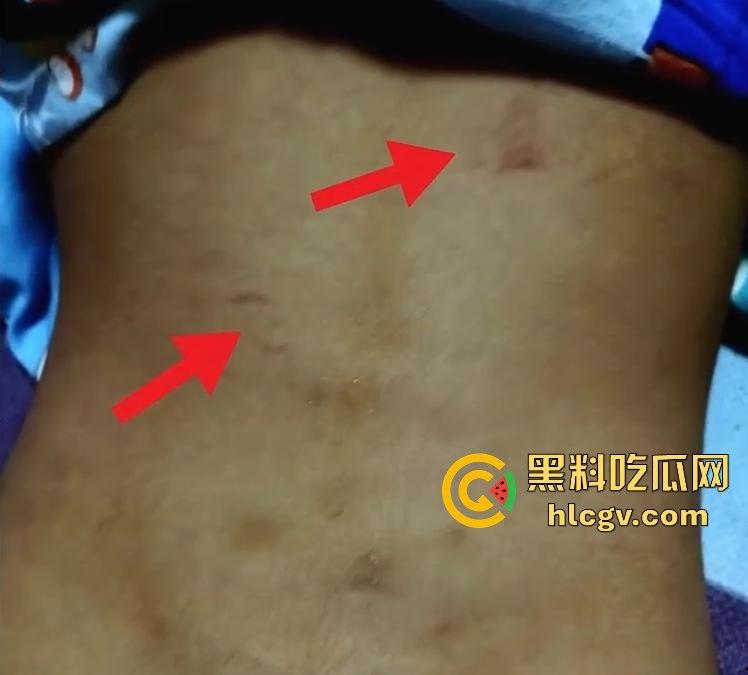 长沙幼儿园虐童！孩子被两名老师拖地打，家长怒发视频控诉！-9