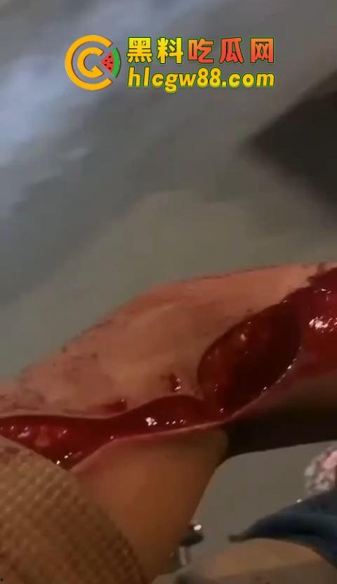 普宁盛产精神小伙，精神小伙又疯了？刀仔砍人血溅街头，这回不是社会摇，是进局子摇！-8