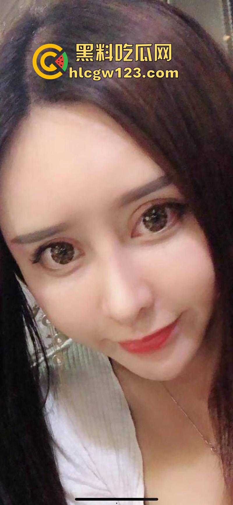 成都整容女生化母体，颜值高身材高挑性感，经常卖逼约炮染上梅毒，到处约炮感染年轻帅哥！-6