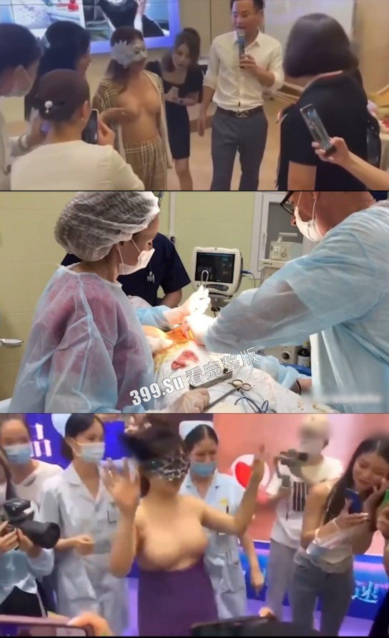 医美整形那些事儿 假的真不了 女人对自己真狠 阴唇黑了就直接切掉 (二)-2