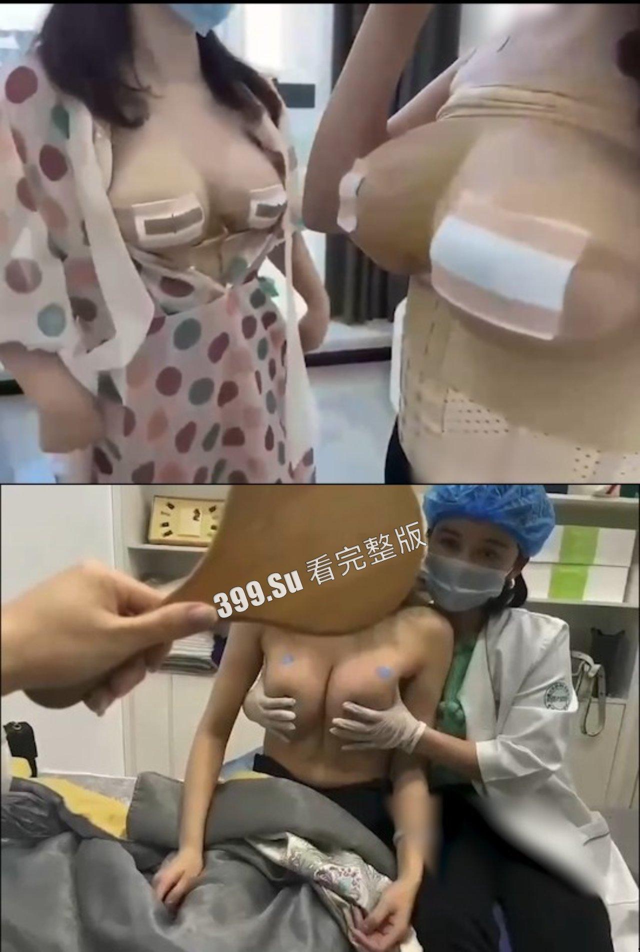 医美整形那些事儿 假的真不了 女人对自己真狠 阴唇黑了就直接切掉 (二)-4