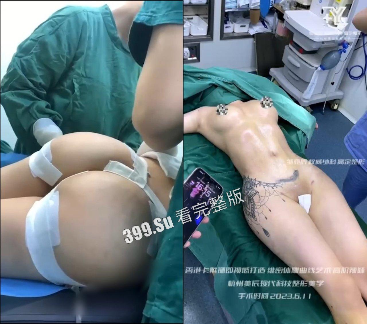 医美整形那些事儿 假的真不了 女人对自己真狠 阴唇黑了就直接切掉 (二)-5