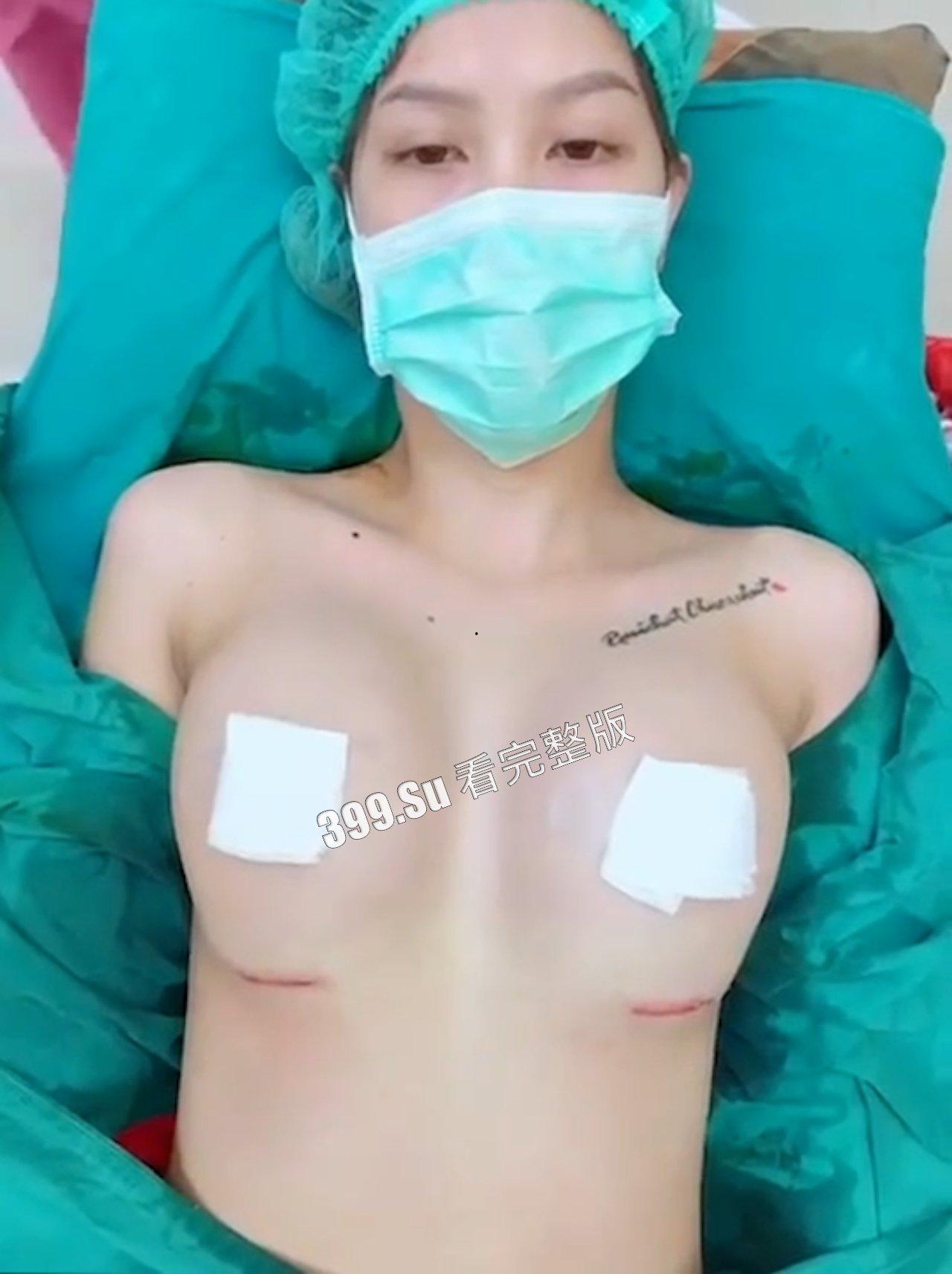 医美整形那些事儿 假的真不了 女人对自己真狠 阴唇黑了就直接切掉 (二)-7