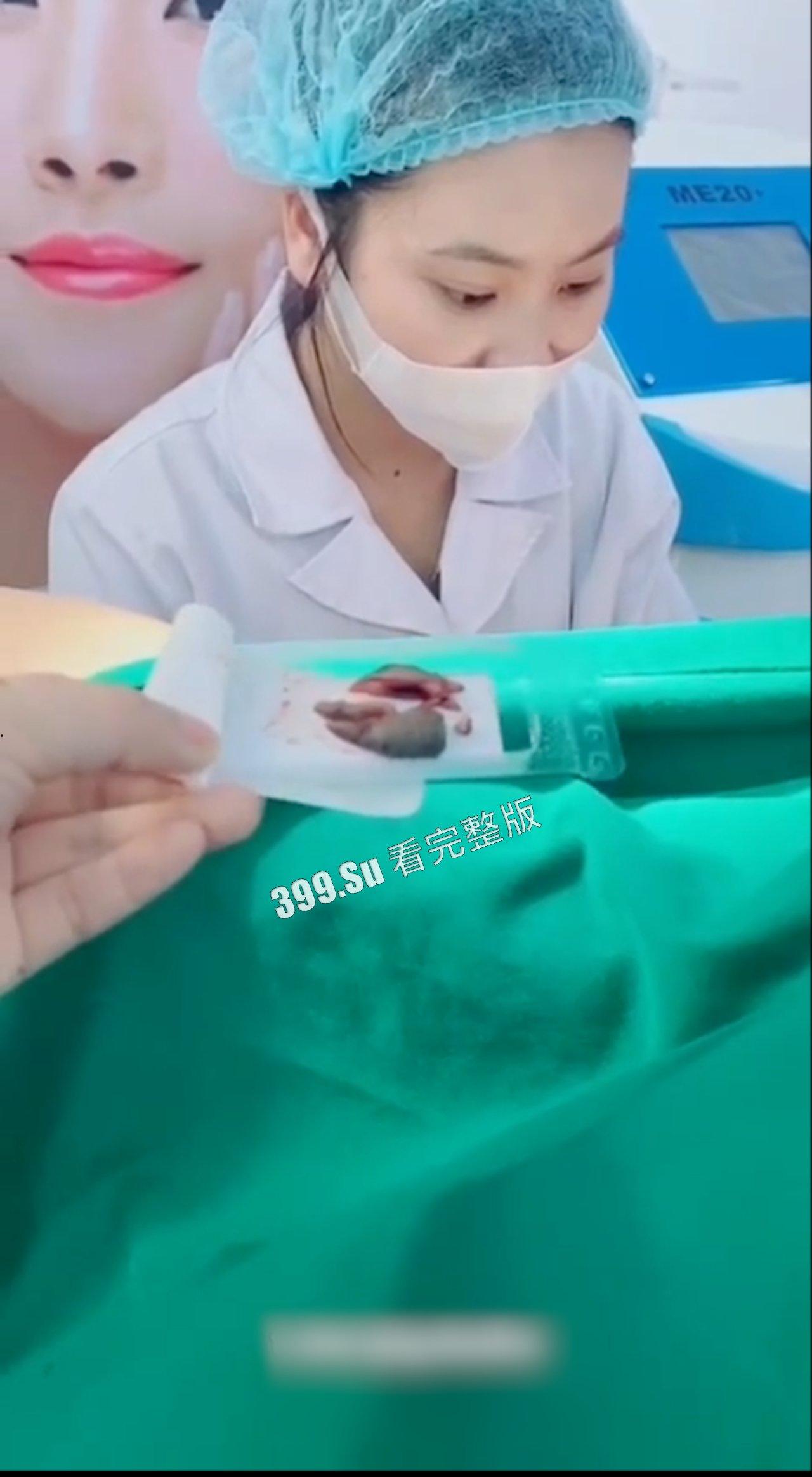 医美整形那些事儿 假的真不了 女人对自己真狠 阴唇黑了就直接切掉 (二)-9