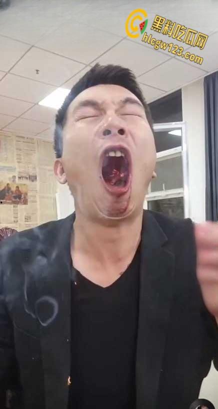 抖音狠人博流量 , 鞭炮嘴炸出血，脑残操作震惊全网 ！-4