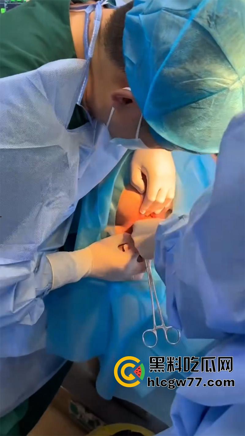 成都肛肠科又来新活，巨屌玩具塞入菊花拔不出来，只能到医院取出，这么大怎么塞进去的呢？-2