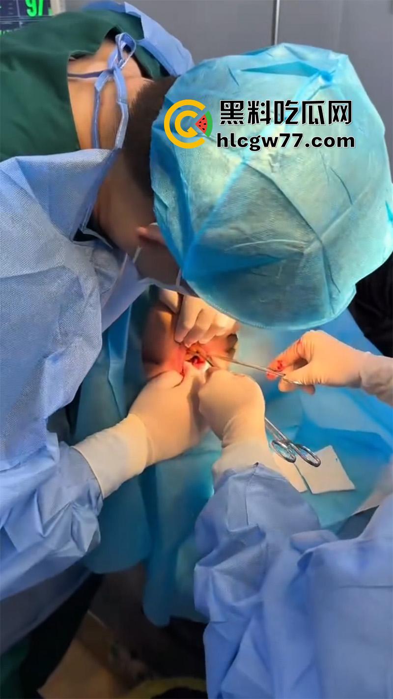 成都肛肠科又来新活，巨屌玩具塞入菊花拔不出来，只能到医院取出，这么大怎么塞进去的呢？-3