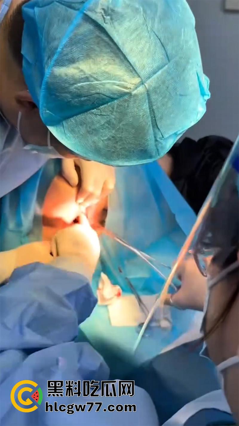 成都肛肠科又来新活，巨屌玩具塞入菊花拔不出来，只能到医院取出，这么大怎么塞进去的呢？-4