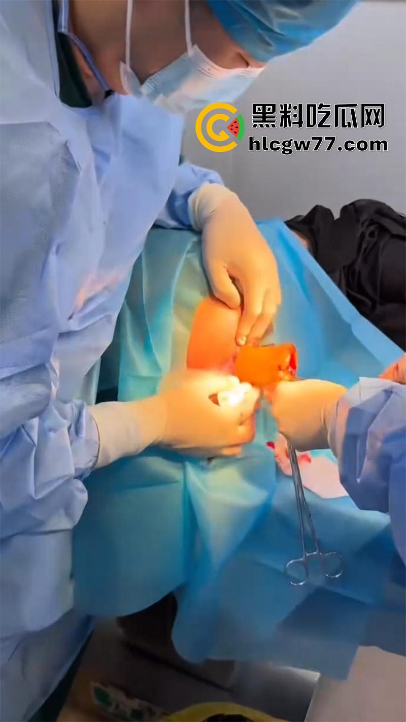 成都肛肠科又来新活，巨屌玩具塞入菊花拔不出来，只能到医院取出，这么大怎么塞进去的呢？-6