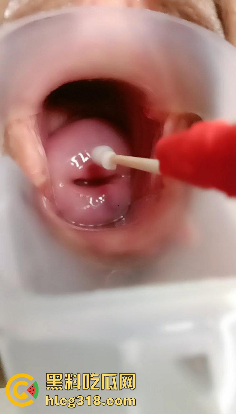 拳头砸逼往死里干,盘点极品大烂逼女孩,极度扩张玩到子宫脱垂,爆插子宫口都给玩脱肛了!-7