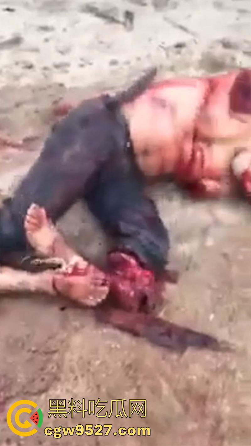 暗网流出血腥合集，吃人腿爆头剥皮车祸，想要的应有尽有，场面血腥过于重口，胆小者谨慎观看！-5