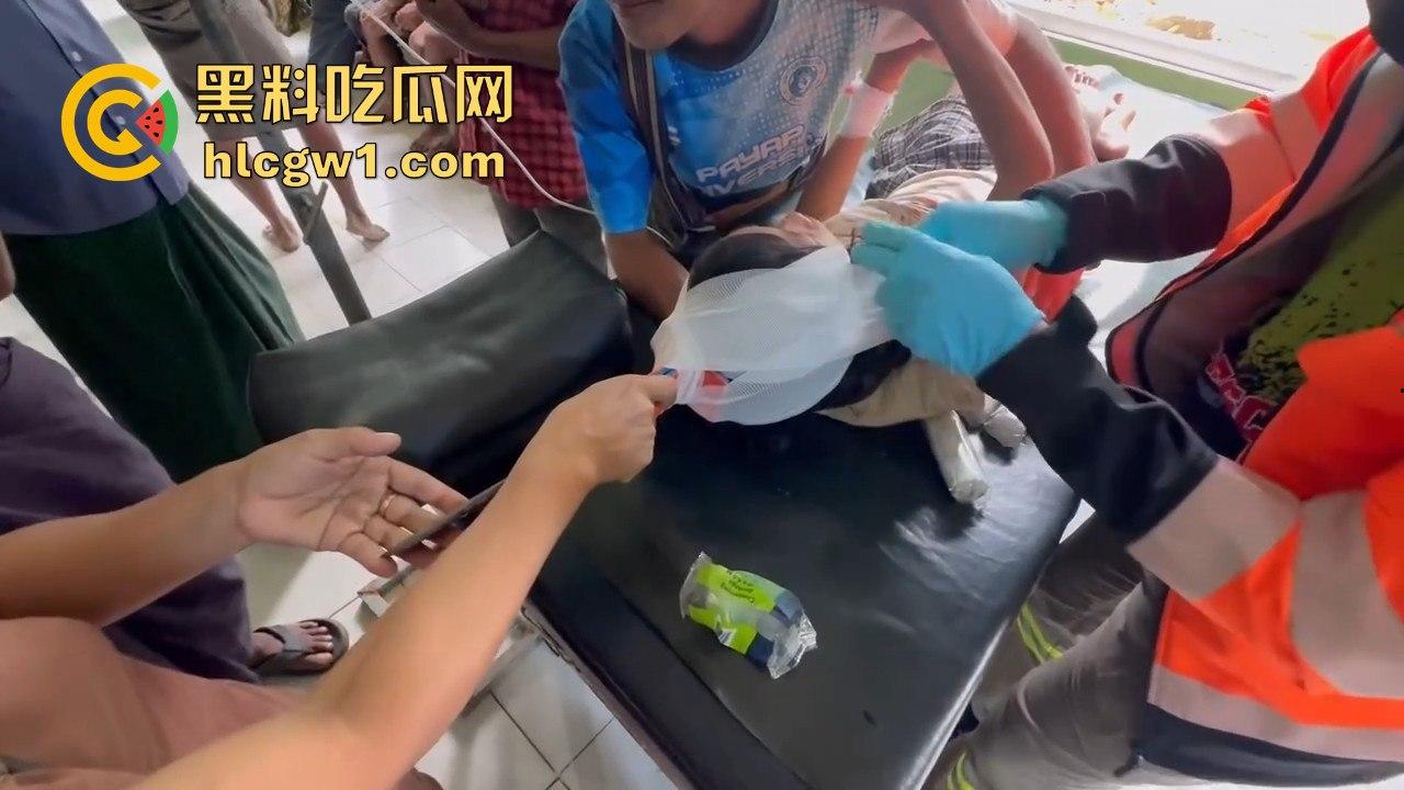 妙瓦底一女孩头部被刀插入！竹片墙掉刀酿惨剧，紧急送往泰国湄索医院！-10