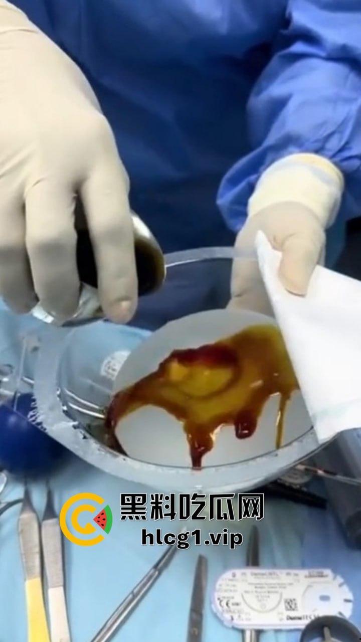 7W就能让你机场变巨乳!抖音上那些36D大胸妹子,原来都是这么来的!-8