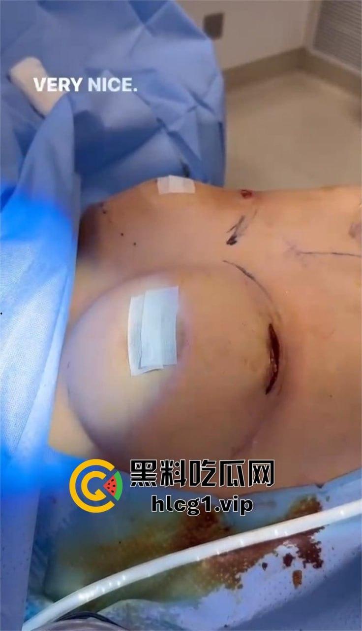 7W就能让你机场变巨乳!抖音上那些36D大胸妹子,原来都是这么来的!-16