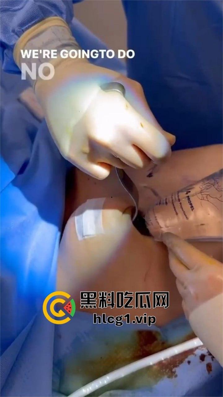 7W就能让你机场变巨乳!抖音上那些36D大胸妹子,原来都是这么来的!-17