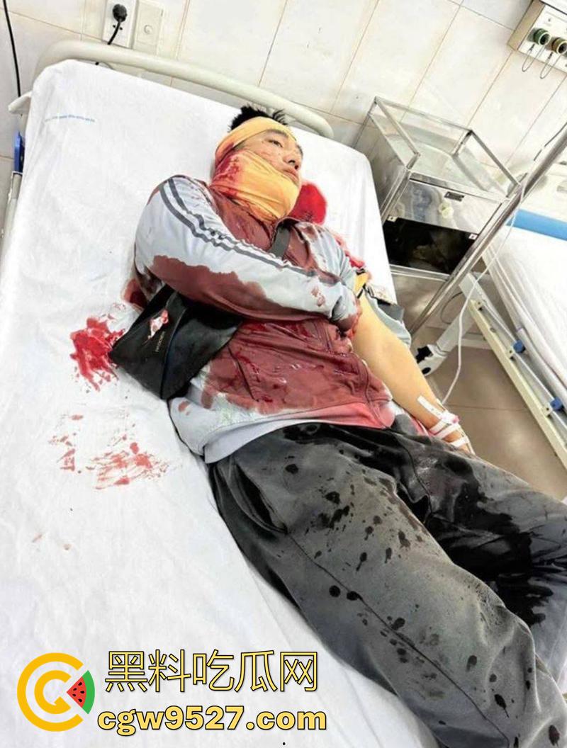 越南海防水果批发市场，发生重大砍人事件，男子手持菜刀疯狂劈砍，导致三人身受重伤，现场视频流出！-2