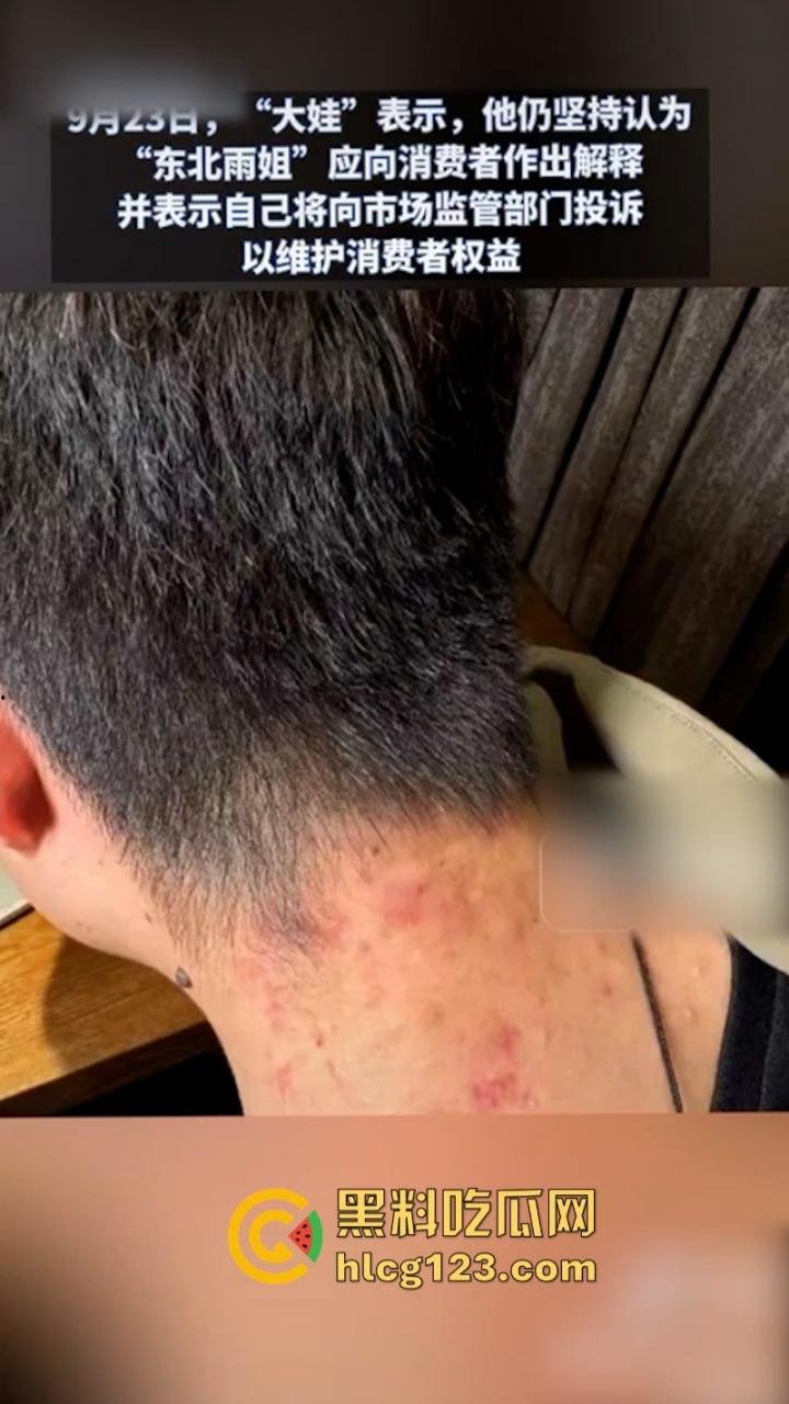 一分钟收入100w?抖音千万网红 【东北雨姐】售卖假红薯粉粉涉嫌虚假宣被打假!-2