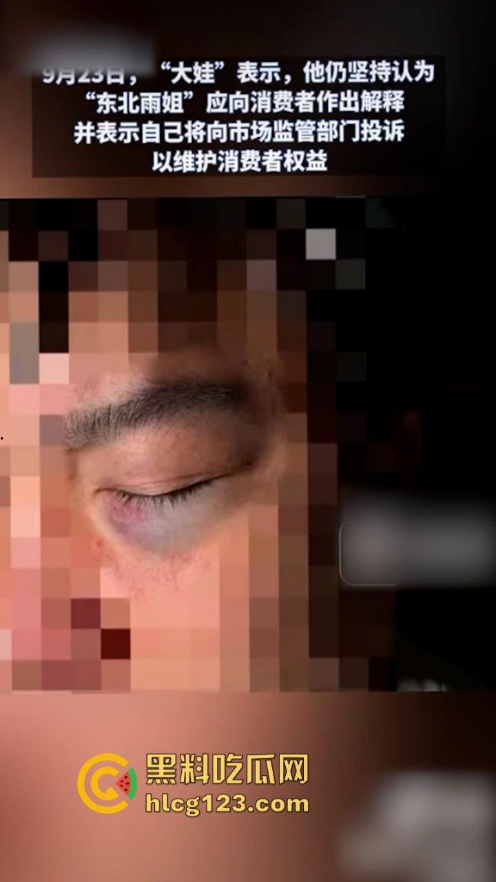 一分钟收入100w?抖音千万网红 【东北雨姐】售卖假红薯粉粉涉嫌虚假宣被打假!-18