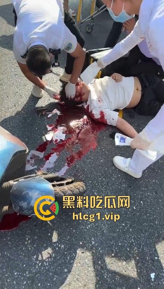 外卖小哥摩托车撞倒女子,女子头破血流浑身抽搐!-1
