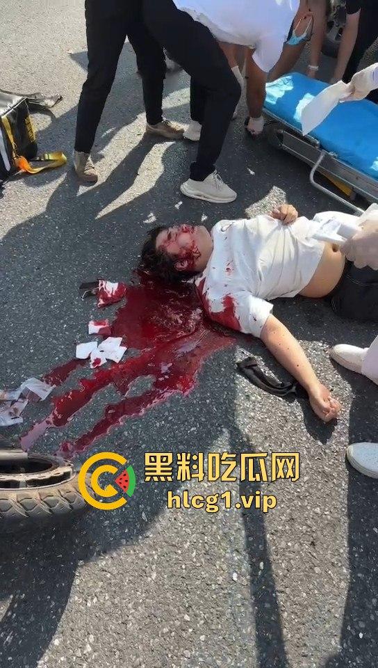 外卖小哥摩托车撞倒女子,女子头破血流浑身抽搐!-3
