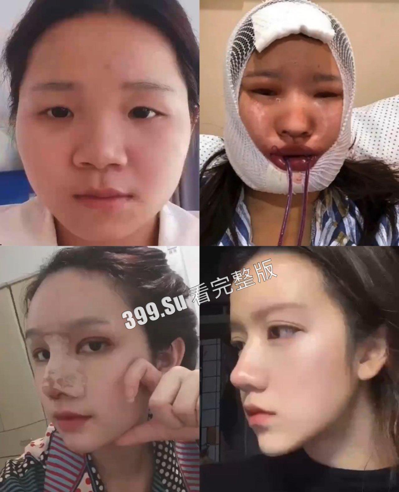 医美整形那些事儿 假的真不了 瓜友们能在生活中分辨出人造人吗?-1