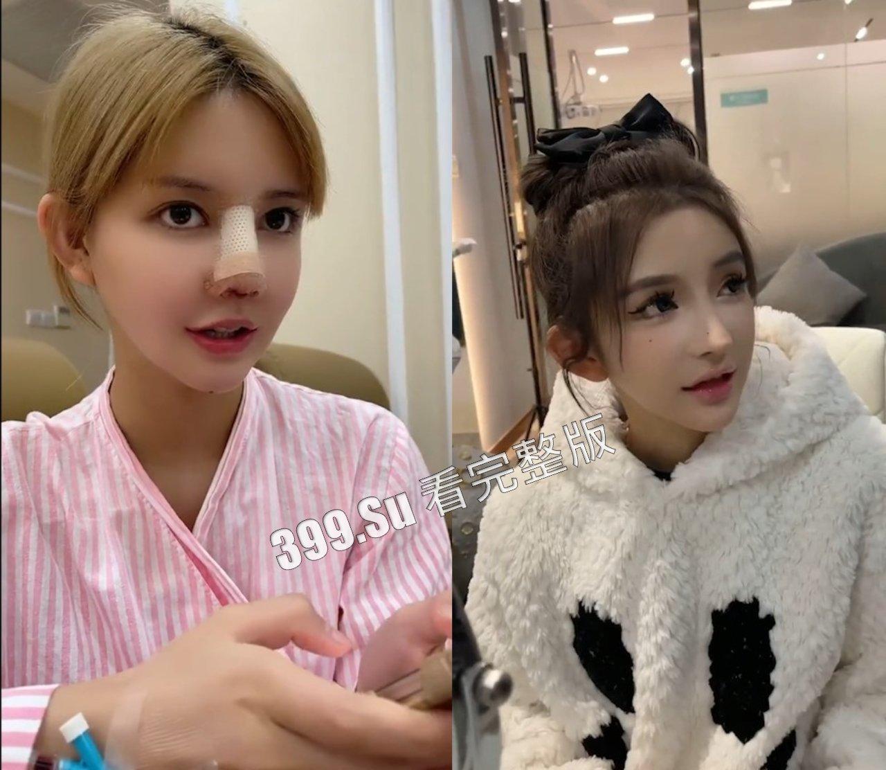 医美整形那些事儿 假的真不了 瓜友们能在生活中分辨出人造人吗?-2