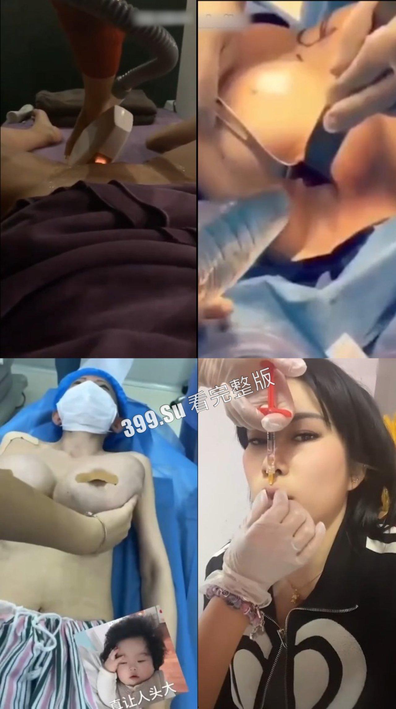 医美整形那些事儿 假的真不了 瓜友们能在生活中分辨出人造人吗?-9