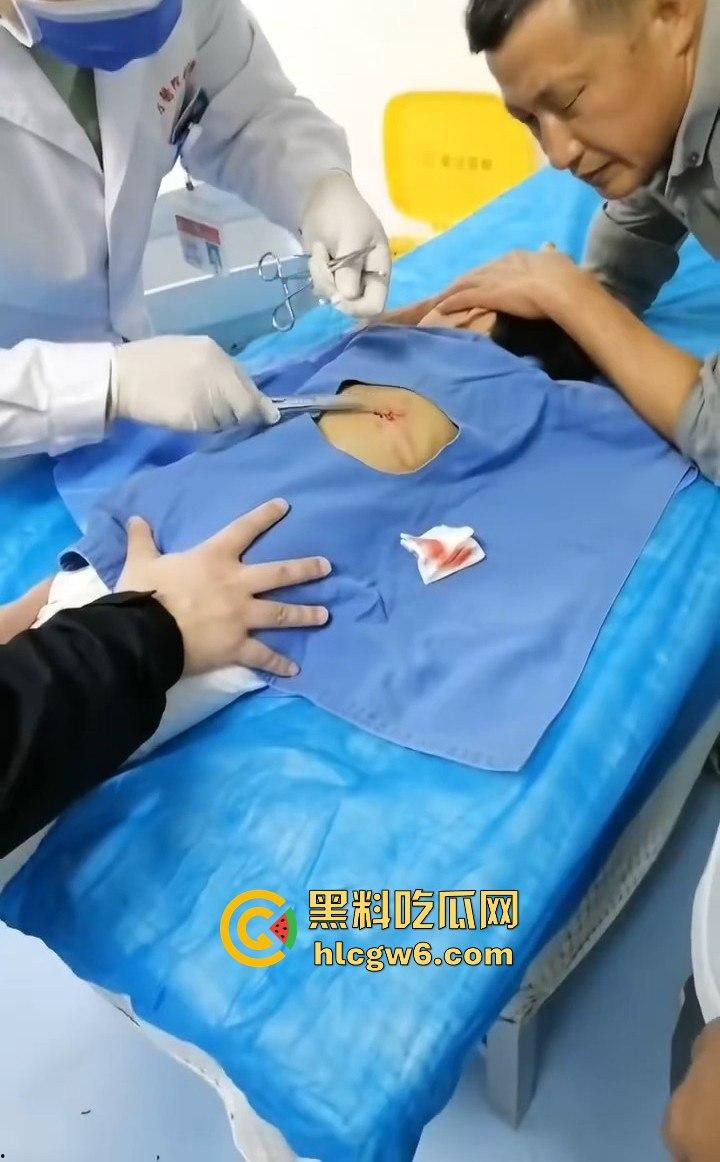 江西赣州母女在公园散步被四条野狗攻击撕咬,扯下来的肉被吃掉,暴露性伤口可以塞进一只手-10