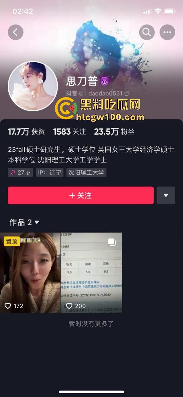 抖音快手高学历骚货【思刀普】视频外流,炮机插穴骚到飞天,情趣内衣一字马淫舞掰腿露逼,高知母狗的淫荡秀真6!-1