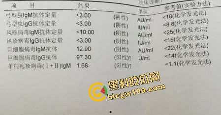 瓜友独家投稿曝光生化母体!化大附中卖淫骚鸡【余纯】600约炮单男,黑丝操逼颜射贱脸!独家流出!-8