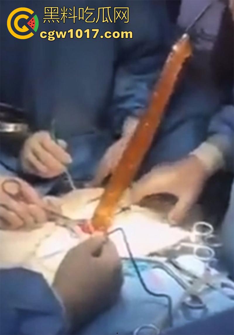 吉林大学三院副院长【刘俊志】,跟杨护士长玩SM,因嗑药嗑多直接玩脱了,护士长竟然被玩挂了!-10