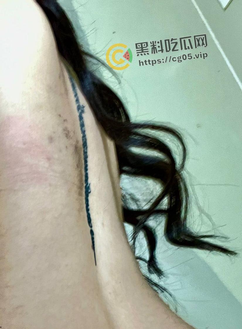 上海鸭王【闫啸天】和鸡婆的狗血爱情故事!鸭王性病 偷吃打鸡婆打到流产 属于是烂人比烂 家暴现场血腥画面流出-6