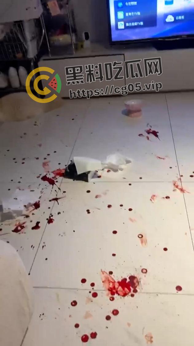 上海鸭王【闫啸天】和鸡婆的狗血爱情故事!鸭王性病 偷吃打鸡婆打到流产 属于是烂人比烂 家暴现场血腥画面流出-12