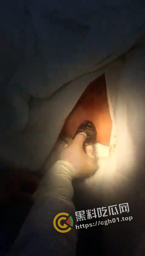 逆天!肛门掏出遥控器 这一定是不小心进去的吧 现场视频流出-3