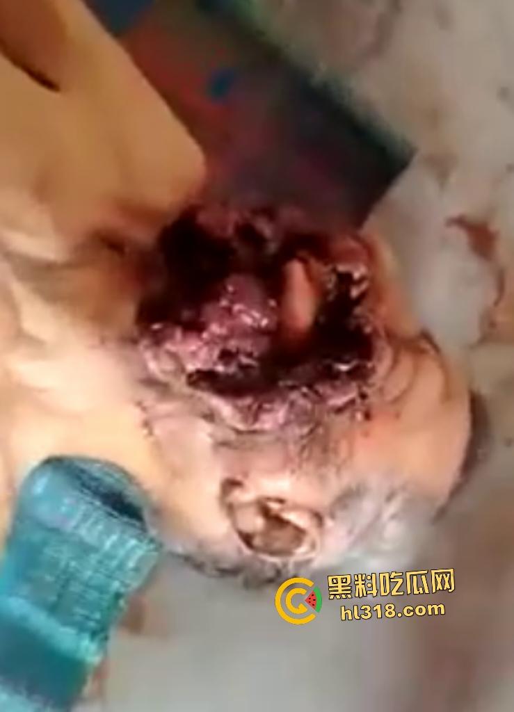 埃及老人惨遭机器重击，脸烂成浆五官全毁，只能阿巴阿巴发声音，不能说话，估计过几天就要长蛆了！-8