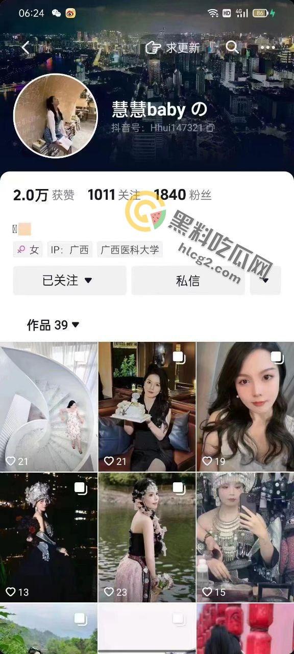 网红慧慧baby出轨丑闻曝光!甜美网红背后的秘密竟如此劲爆!-1