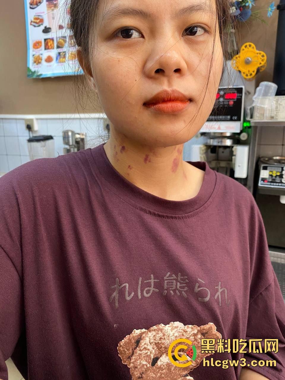 河南骚货【赵露露】的母狗身份被男友实锤 ,裸照生活照全曝光,脖子草莓遍布像得了病一样-10