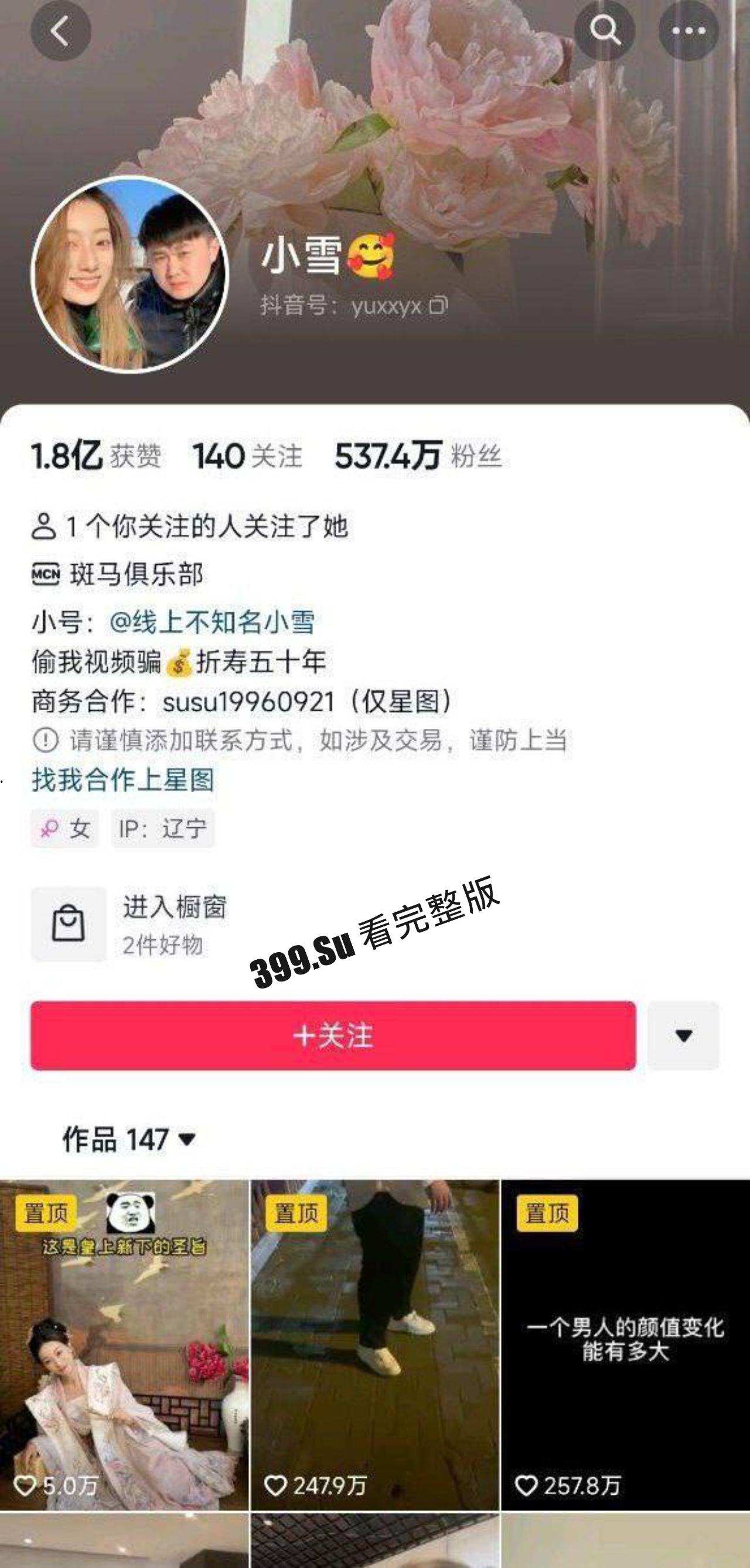 抖音500万粉博主 小雪(两千万粉 张百乔 媳妇) 裸照曝光 身材真不错 雀黑-1