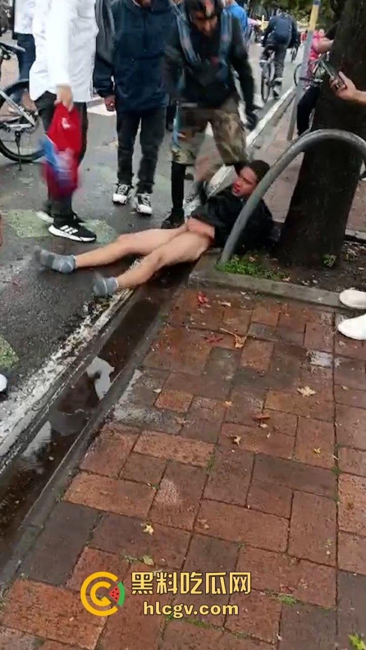 蛋痛！加州小偷扒钱包被抓现行 惨遭正义群众群体攻击 脱裤捏蛋：叫成这样是爆了吗？-4