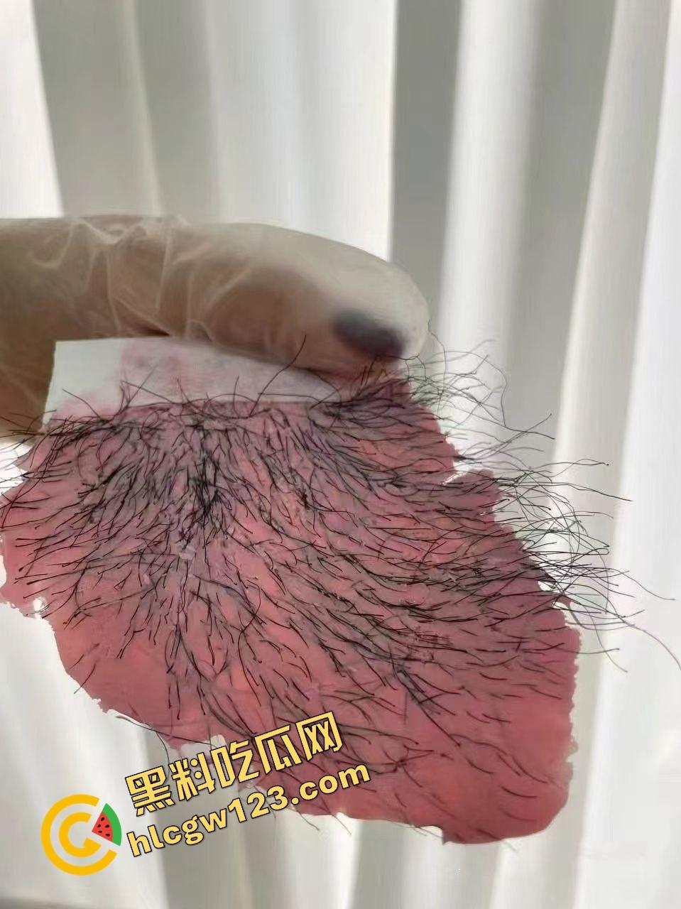 白虎不是天生的,是拔出来的,人工白虎养骗局曝光逼毛一根根扯,看得人蛋蛋一紧!-11