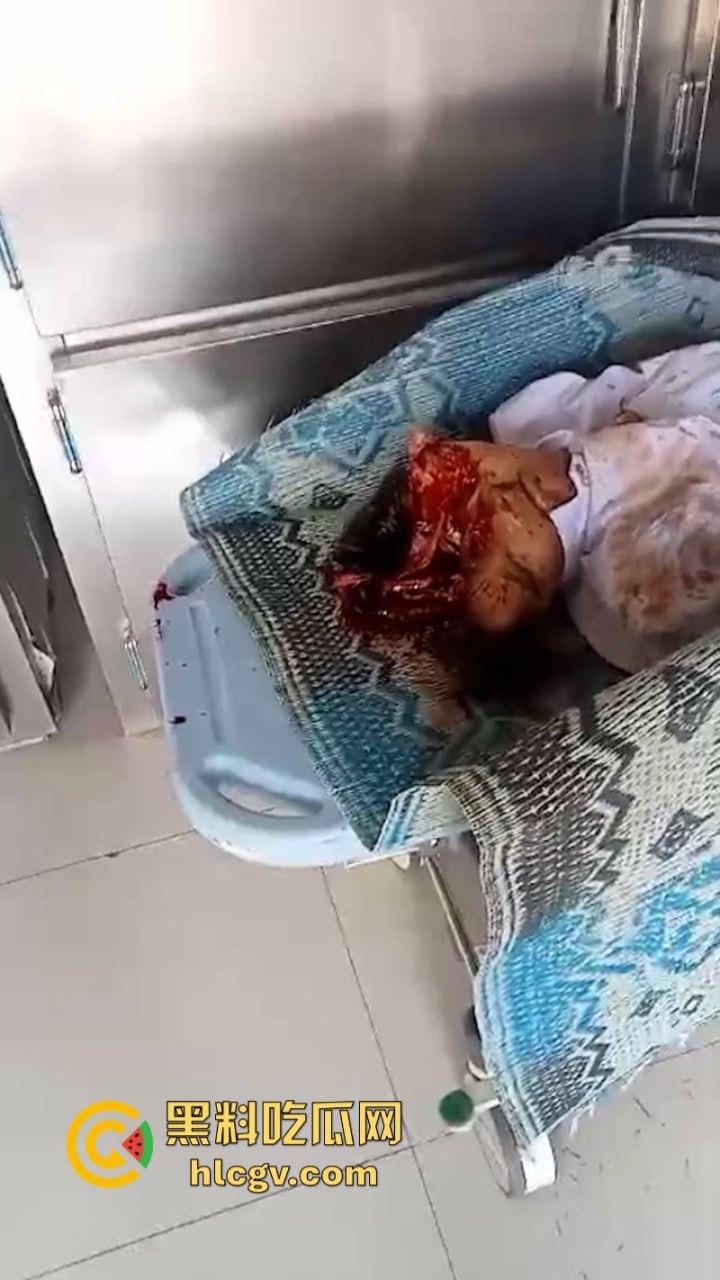 印尼惨烈车祸真实影像惨不忍睹 两人命丧车轮身首分离 胆小慎入-9